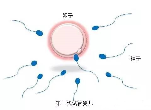 极光生殖